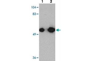 Western blot analysis of KREMEN1 in rat small intestine tissue with KREMEN1 polyclonal antibody  at (lane 1) 0. (KREMEN1 Antikörper  (C-Term))