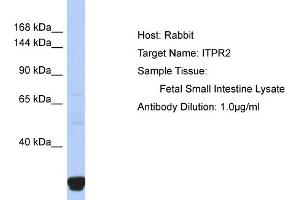 Western Blotting (WB) image for anti-Inositol 1,4,5-Trisphosphate Receptor, Type 2 (ITPR2) (N-Term) antibody (ABIN2776138)