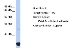 Host: Rabbit Target Name: ITPR2 Sample Type: Fetal Small Intestine lysates Antibody Dilution: 1. (ITPR2 Antikörper  (N-Term))