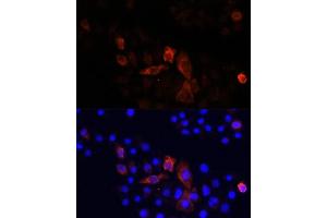 Immunofluorescence analysis of HeLa cells using MT-ND2 antibody (ABIN7268600) at dilution of 1:100. (MT-ND2 Antikörper  (C-Term))