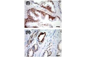 IHC for USP2a in a formalin-fixed, paraffin-embedded human prostate sample.