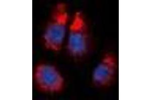 Immunofluorescent analysis of Alpha-1A Adrenergic Receptor staining in NIH3T3 cells.