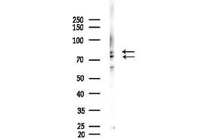 Western blot analysis of lysates from Mouse lung, using Synapsin I Antibody at 1/1000 dilution.