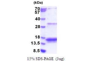 SDS-PAGE (SDS) image for Eukaryotic Translation Initiation Factor 4E Binding Protein 3 (EIF4EBP3) (AA 1-100) protein (His tag) (ABIN5853824) (EIF4EBP3 Protein (AA 1-100) (His tag))