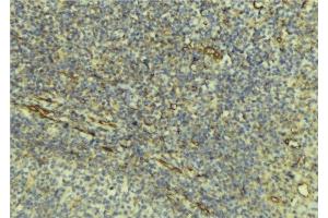 Immunohistochemistry (IHC) image for anti-Tumor Necrosis Factor Receptor Superfamily, Member 10c (TNFRSF10C) antibody (ABIN6265636)