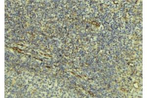 ABIN6276540 at 1/100 staining Human lymph tissue by IHC-P. (DcR1 Antikörper)