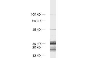 dilution: 1 : 1000, sample: synaptic vesicle fraction (LP2) of rat brain