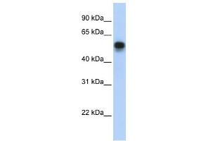 WB Suggested Anti-IRF6 Antibody Titration:  0. (IRF6 Antikörper  (Middle Region))