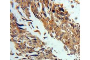 IHC-P analysis of ovary tissue, with DAB staining. (TGM3 Antikörper  (AA 468-693))