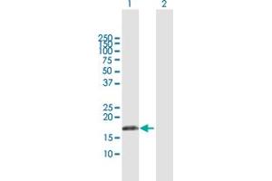 Western Blot analysis of IFNA17 expression in transfected 293T cell line by IFNA17 MaxPab polyclonal antibody. (IFNA17 Antikörper  (AA 1-189))