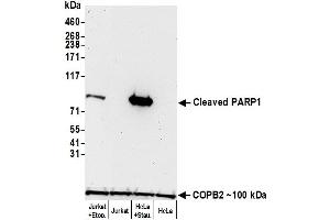 Western Blotting (WB) image for anti-Poly (ADP-Ribose) Polymerase 1 (PARP1) (AA 215-265) antibody (ABIN7455116)