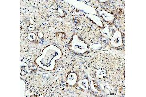 anti-BCL2-Like 1 (BCL2L1) (AA 1-219) antibody