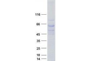 Validation with Western Blot