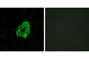 Peptide - +Immunofluorescence analysis of MCF-7 cells, using BAI1 antibody. (BAI1 Antikörper  (Internal Region))