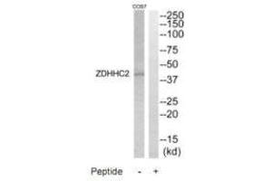 Western blot analysis of extracts from COS7 cells, using ZDHHC2 antibody. (ZDHHC2 Antikörper)
