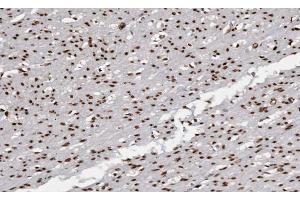 ABIN6266672 at 1/100 staining human Smooth muscle tissue sections by IHC-P. (USF2 Antikörper  (Internal Region))