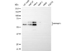 Western blotting analysis using EFEMP1 antibody (ABIN7798617).