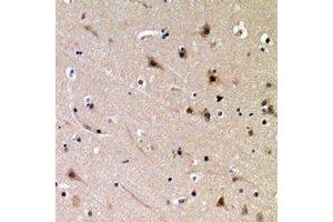 Immunohistochemical analysis of DDX3X (pT322) staining in human brain formalin fixed paraffin embedded tissue section.