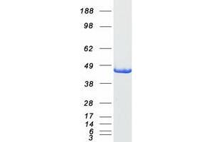 Western Blotting (WB) image for Alanine Glyoxylate Aminotransferase (AGXT) protein (Myc-DYKDDDDK Tag) (ABIN2714469)