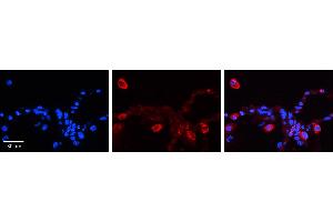 PCDHGC4 antibody - N-terminal region          Formalin Fixed Paraffin Embedded Tissue:  Human Lung Tissue    Observed Staining:  Cytoplasm of pneumocytes   Primary Antibody Concentration:  1:100    Secondary Antibody:  Donkey anti-Rabbit-Cy3    Secondary Antibody Concentration:  1:200    Magnification:  20X    Exposure Time:  0.