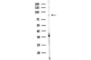 Western blot analysis of lysates from MDA-MB-231 cells(heat-shock,45 min treatment), using EZH1 Antibody at 1/1000 dilution.