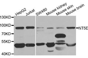 Western blot analysis of extracts of various cell lines, using NT5E antibody (ABIN5971061) at 1/1000 dilution. (CD73 Antikörper)