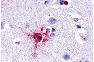 Anti-Delta Opioid Receptor antibody  ABIN1048495 IHC staining of human brain, neurons and glia. (OPRD1 Antikörper  (N-Term))
