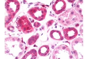 Immunohistochemistry (IHC) image for anti-KRR1, Small Subunit (SSU) Processome Component, Homolog (KRR1) (AA 47-344) antibody (ABIN1930791)