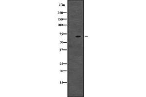 Western blot analysis of CENPT expression in ; HepG2 cell lysate,The lane on the left is treated with the antigen-specific peptide.
