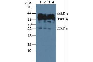 Western blot analysis of (1) Human HeLa cells, (2) Human A549 Cells, (3) Human Jurkat Cells and (4) Human 293T Cells. (HDGF Antikörper  (AA 10-240))