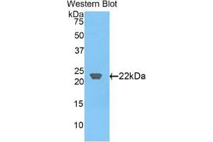 Western blot analysis of the recombinant protein. (CLEC3B Antikörper  (AA 22-202))
