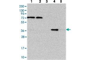 Western blot analysis of Lane 1: RT-4, Lane 2: U-251 MG, Lane 3: Human Plasma, Lane 4: Liver, Lane 5: Tonsil with C11orf54 polyclonal antibody . (C11orf54 Antikörper)
