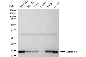 Western blotting analysis using Galectin 1 antibody (ABIN7799243).