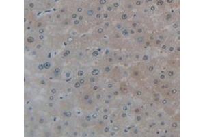 IHC-P analysis of Human Tissue, with DAB staining. (VRK1 Antikörper  (AA 46-292))