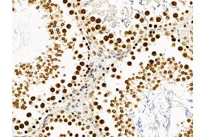 ABIN6265482 and ABIN6269020 at 1/100 staining Rat testis tissue by IHC-P. (TBP Antikörper  (N-Term))