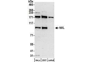 Western Blotting (WB) image for anti-Nuclear VCP-Like (NVL) (AA 75-125) antibody (ABIN7450517)