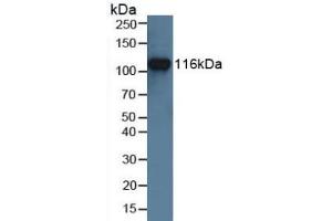 Detection of MUSK in Human Jurkat Cells using Polyclonal Antibody to Muscle, Skeletal, Receptor Tyrosine Kinase (MUSK) (MUSK Antikörper  (AA 517-777))