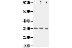 Anti-Kallikrein 1 antibody, Western blotting Lane 1: Recombinant Human KLK1 Protein 10ng Lane 2: Recombinant Human KLK1 Protein 5ng Lane 3: Recombinant Human KLK1 Protein 2. (Kallikrein 1 Antikörper  (Middle Region))