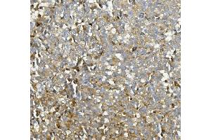 IHC analysis of ASAH1 using anti-ASAH1 antibody (ABIN7602206).