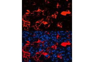 Immunofluorescence analysis of human liver cancer cells using Albumin antibody (ABIN3021924, ABIN3021925, ABIN3021926, ABIN1512560 and ABIN6217701) at dilution of 1:100. (Albumin Antikörper)