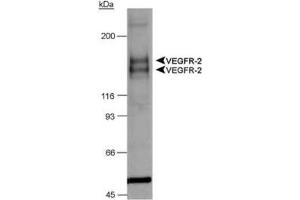 Image no. 2 for anti-Fms-Related tyrosine Kinase 1 (VEGFR1) (FLT1) (AA 800-900), (Internal Region) antibody (ABIN363475) (FLT1 Antikörper  (Internal Region))