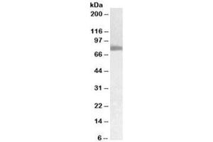 Western blot testing of human pancreas cancer lysate with TGM2 antibody at 0. (Transglutaminase 2 Antikörper)