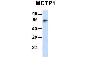 Host:  Rabbit  Target Name:  MCTP1  Sample Type:  Human Adult Placenta  Antibody Dilution:  1. (MCTP1 Antikörper  (Middle Region))