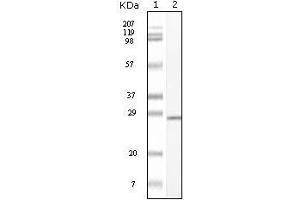 Western Blot showing C-kit antibody used against truncated C-kit recombinant protein. (KIT Antikörper)