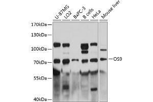 Western blot analysis of extracts of various cell lines, using OS9 antibody (ABIN6131415, ABIN6145063, ABIN6145064 and ABIN6215868) at 1:3000 dilution. (OS9 Antikörper  (AA 353-612))