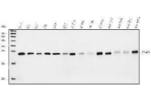Western blot analysis of Proteasome 20S Beta 6/PSMB6 using anti-Proteasome 20S Beta 6/PSMB6 antibody (ABIN7601899).