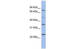 Image no. 1 for anti-Protein Phosphatase, Mg2+/Mn2+ Dependent, 1K (PPM1K) (C-Term) antibody (ABIN6743697)