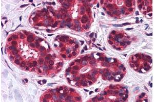 Human Breast: Formalin-Fixed, Paraffin-Embedded (FFPE) (SLC5A6 Antikörper  (Internal Region))