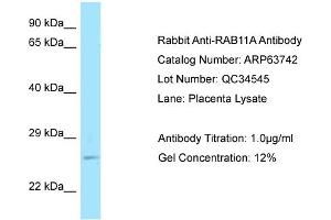 Western Blotting (WB) image for anti-RAB11A, Member RAS Oncogene Family (RAB11A) (C-Term) antibody (ABIN2789607) (RAB11A Antikörper  (C-Term))