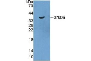 Detection of Recombinant STATH, Human using Polyclonal Antibody to Statherin (STATH) (STATH Antikörper  (AA 1-62))